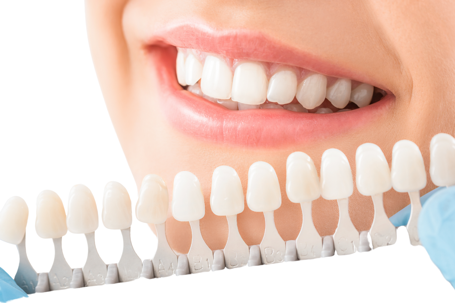 Dental Checkup