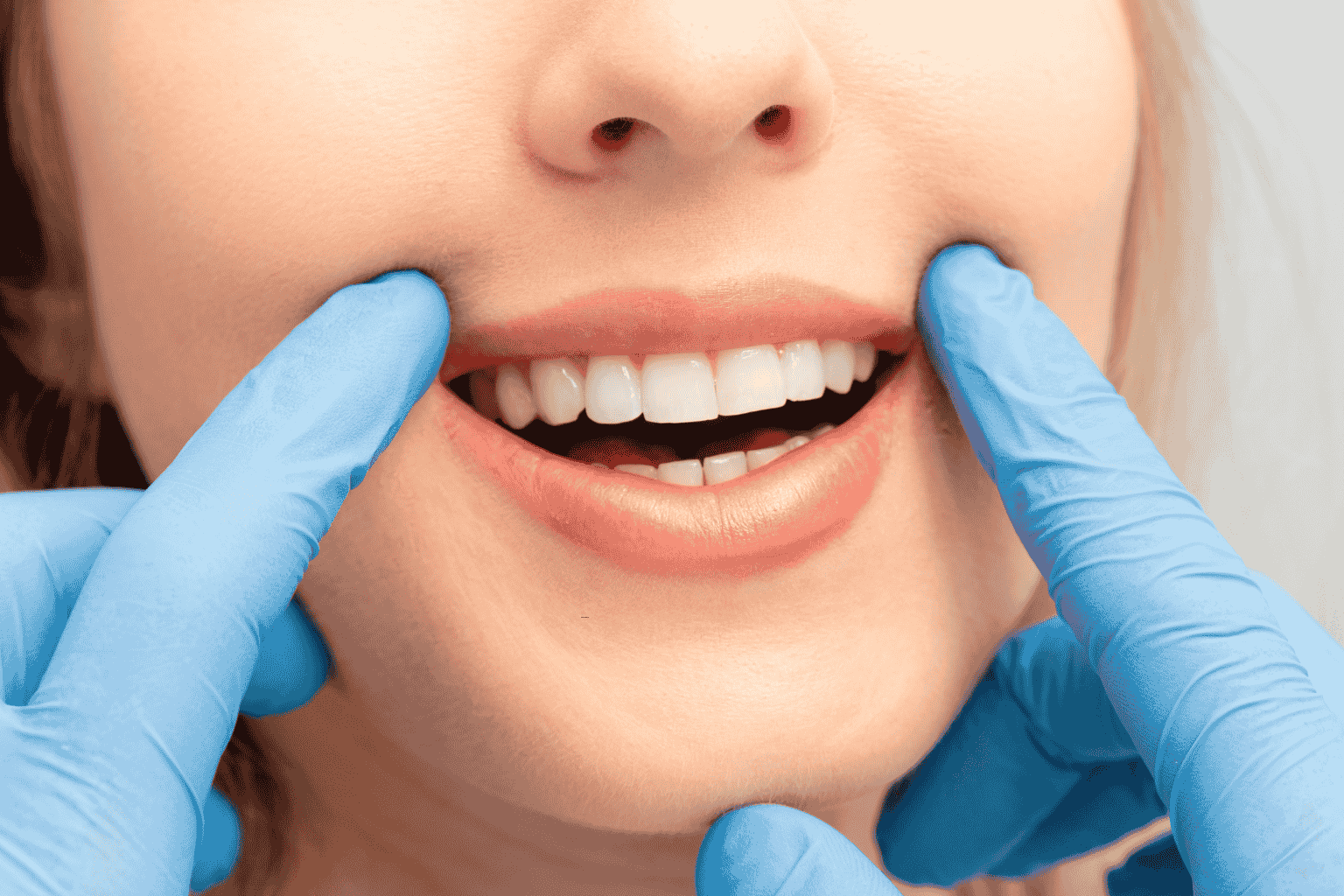 Teeth Whitening Keperra